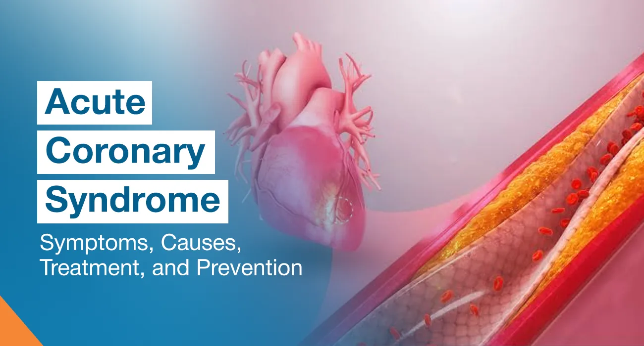 Acute Coronary Syndrome: Symptoms, Causes, Treatment, and Prevention